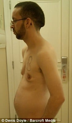 IVF for man formerly pregnant with twins IVF for man formerly pregnant with twins