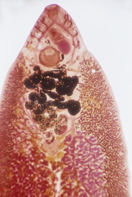 Liver-dwelling parasite infects 400 in Spain Liver-dwelling parasite infects 400 in Spain