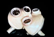 First permanent artificial heart to beat in Spain First permanent artificial heart to beat in Spain