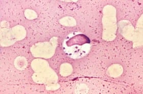 Canine disease spreads to humans Canine disease spreads to humans