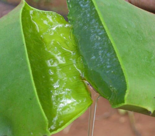 Too much sun? Try these natural cures Too much sun? Try these natural cures