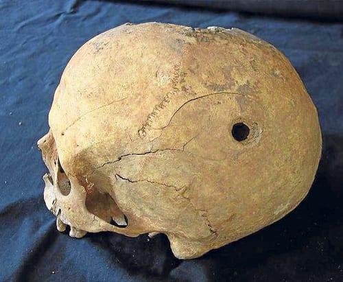 Medieval skulls discovered in Spain Medieval skulls discovered in Spain