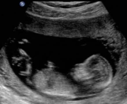 Stillborn legislation amended in Gibraltar Stillborn legislation amended in Gibraltar