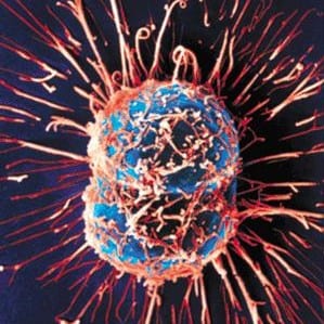 cancer cell e
