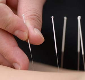 acupuncture is effective in treatment of chronic pain