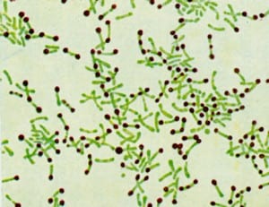 BACTERIA: Corynebacterium diphtheriae