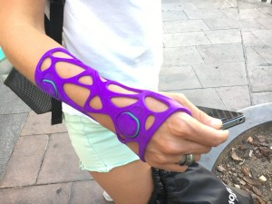 3D cast