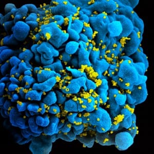HIV cell