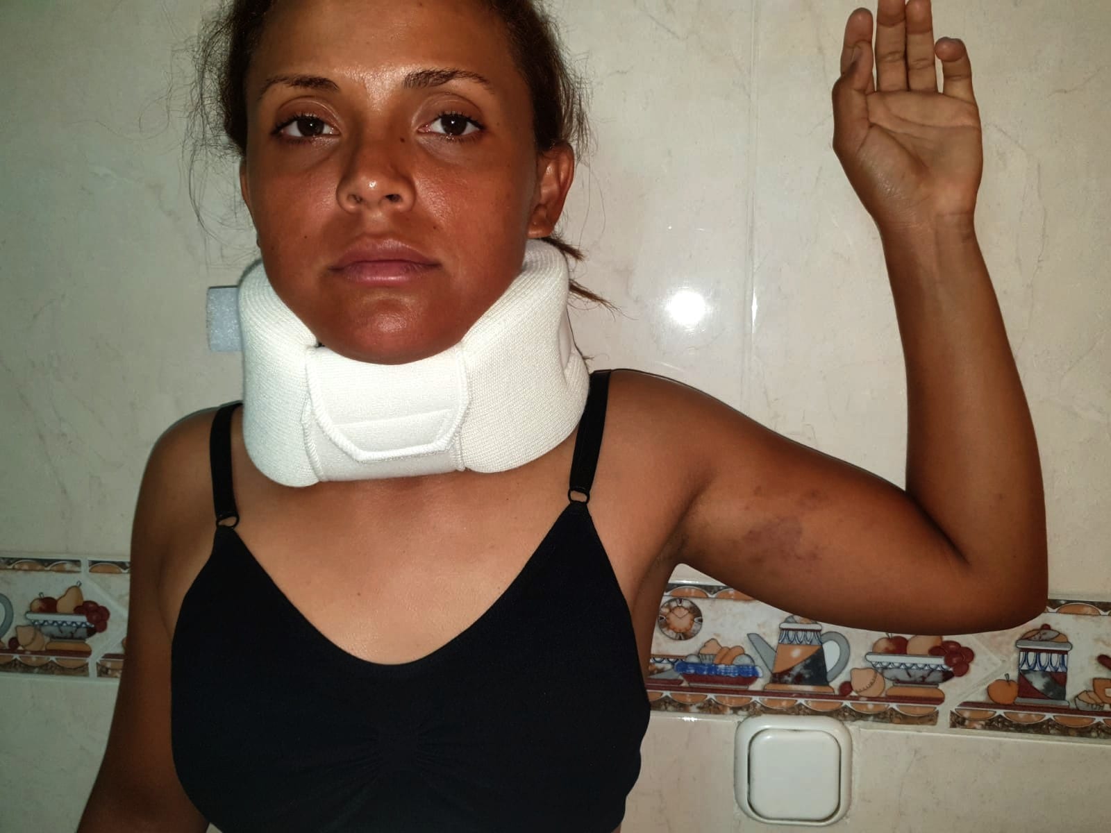 Racist-attack-injuries-fresh