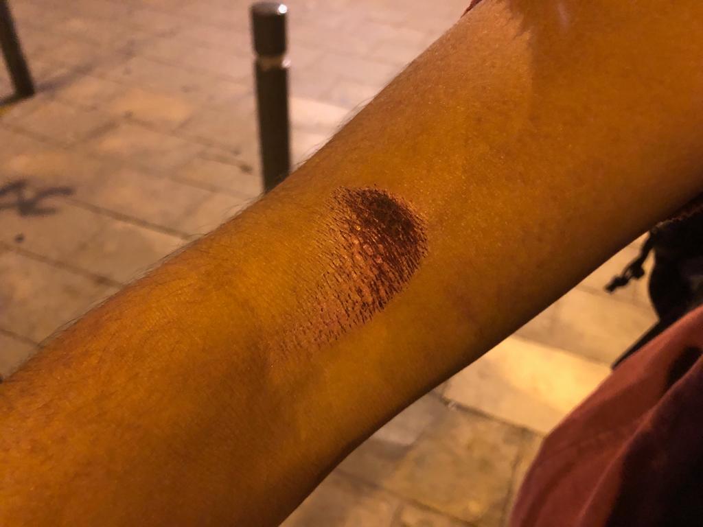 WATCH Wall of police fires on protestors as rocks and rubber bullets