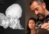 10-year-old Congolese boy dies on flight home after Valencian humanitarian doctor ‘saved his life’ removing facial tumour larger than boy’s own head Img_fcastanyer_20200128 134843_imagenes_lv_otras_fuentes_frame_ok Kgye 656x369 Lavanguardia Web