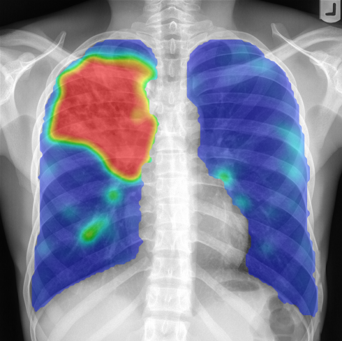 Xray Highres Heatmap