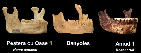 Jaw Bone Comparisons