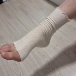 Merce Jurado Moreno Injured Foot In Barcelona Train Smash