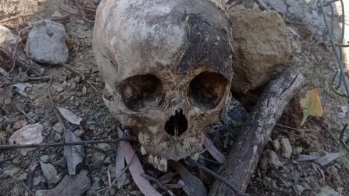 Agnese Klavina Skull