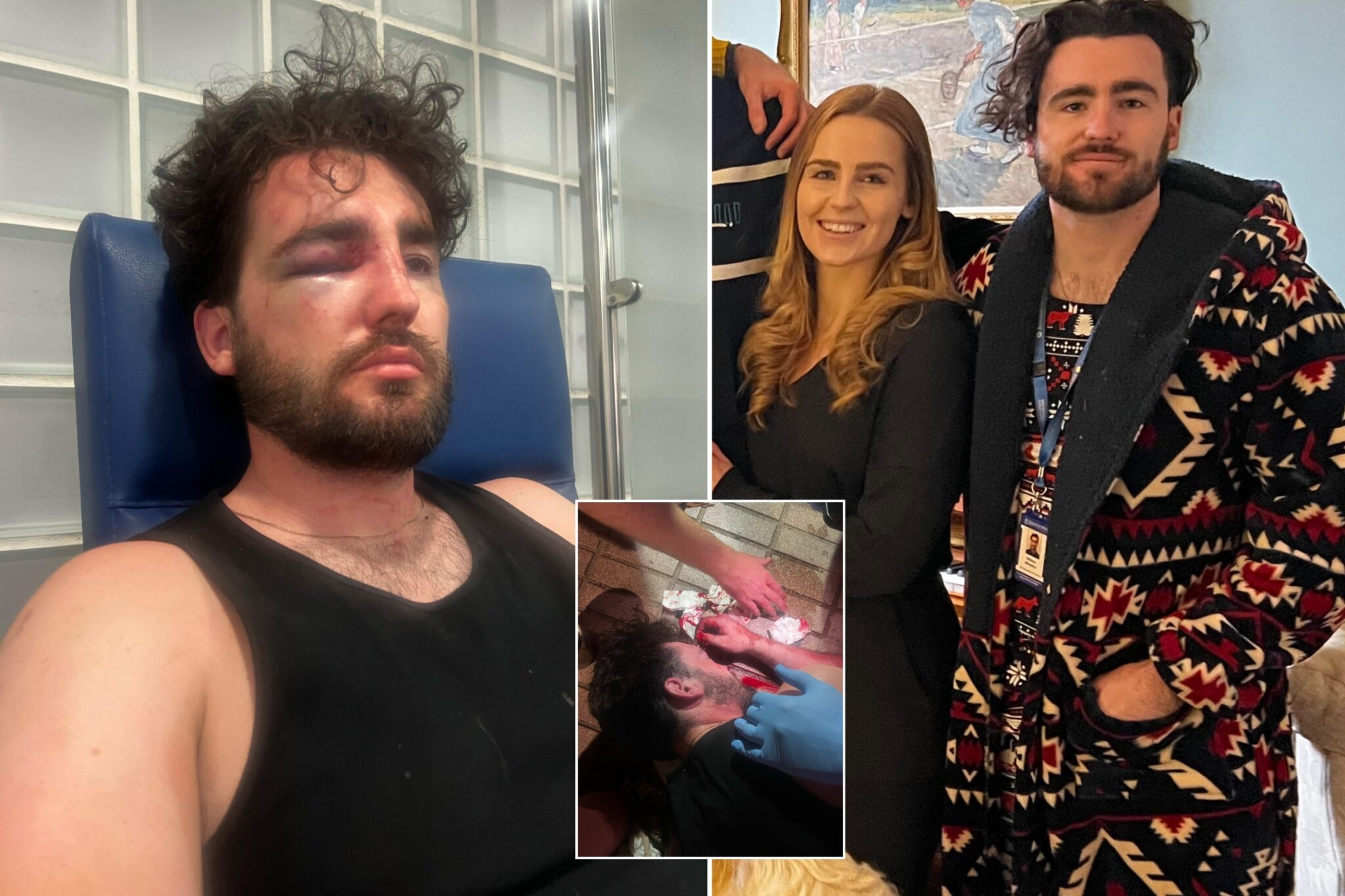 Exclusive British groomtobe needs facial reconstruction surgery