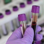 Spanish health expert gives 'little tip' to improve blood test results