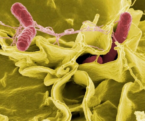 Salmonella, Store medisinske leksikon