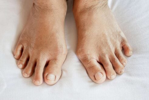 Surgeon arrested after DIY home amputation of his father's toes and subsequent death at Alicante hospital