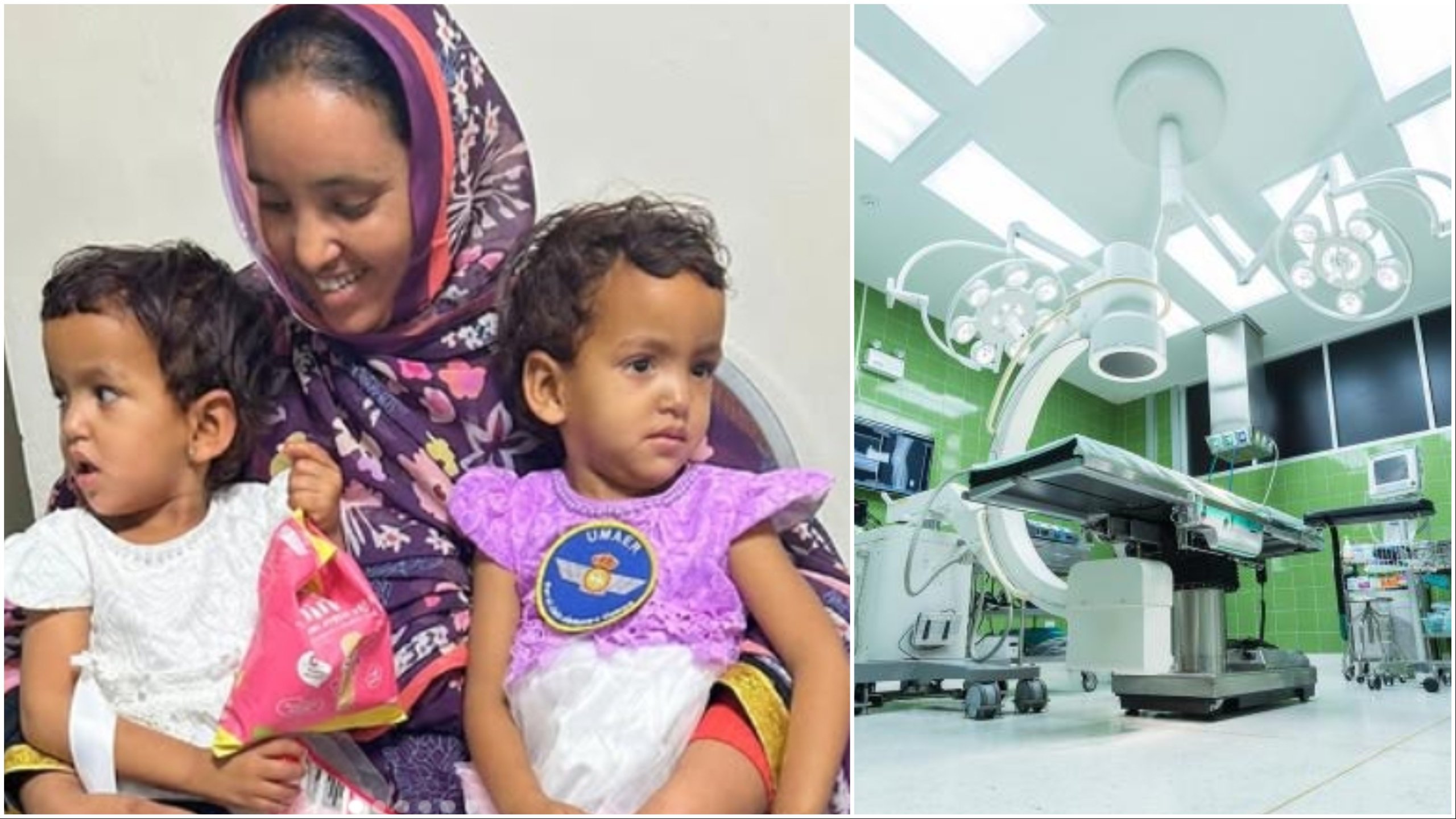 Successful separation of Siamese twins in Barcelona hospital chalked up as another impressive medical operation after historic face transplant