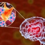 Girl,17, dies from meningitis in Costa Blanca hospital as search takes place to trace teen's recent contacts